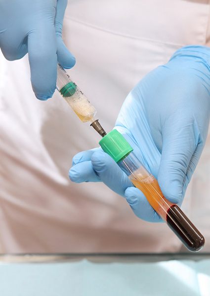 doctor putting PRP into a syringe 