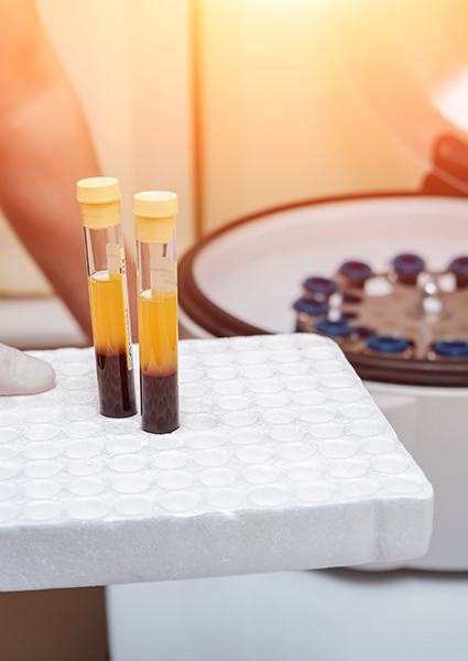 Separated blood and platelet rich plasma for autograft treatment