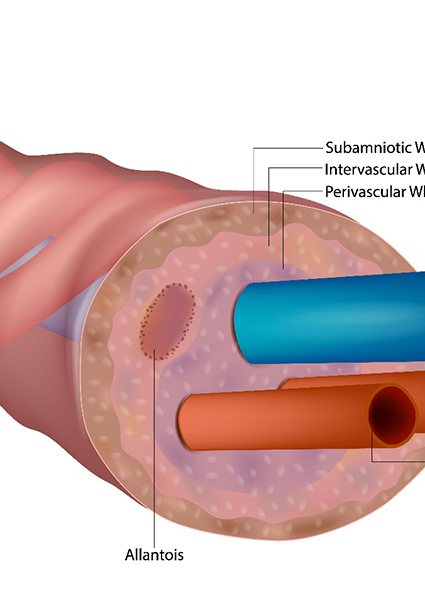 Diagram of umbilical cord showing Wharton’s jelly